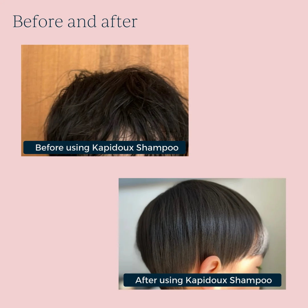 Toofruit Kapidoux Shampooing | My Dermo-Soothing Shampoo