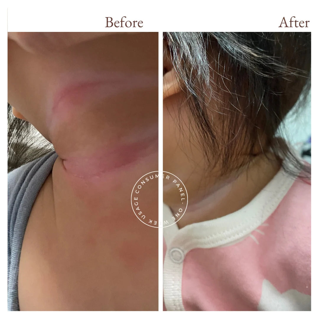 Vivaiodays Olive Oil Rescue Balm Gel